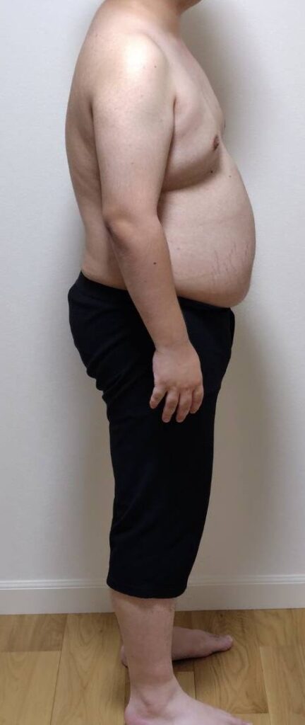 ダイエット開始時の側面像