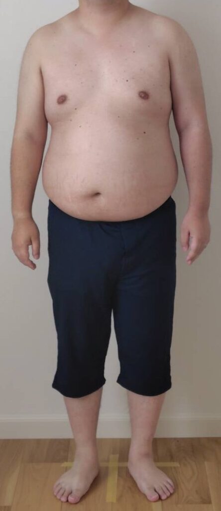 ダイエット開始1週間目の正面像